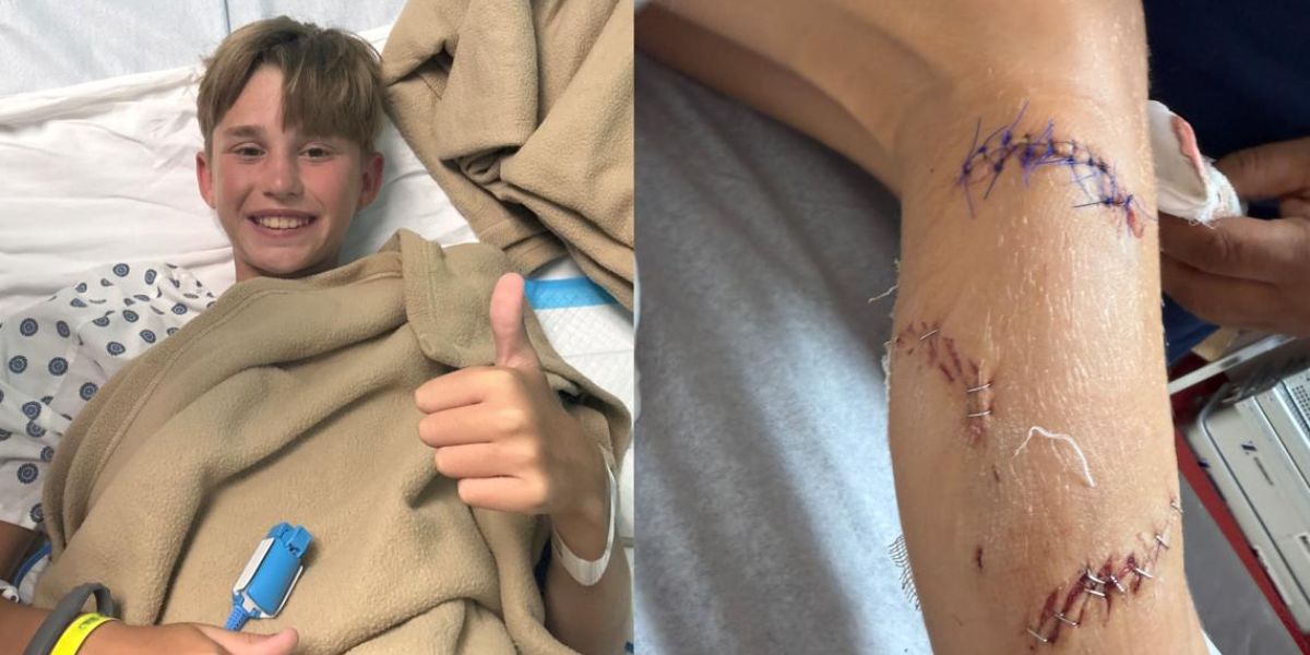 12-Year-Old Boy Loses Dangerous Amount of Blood After Shark Bites Through His Leg in the Bahamas — His Brother's Split-Second Decision May Have Kept Him Alive